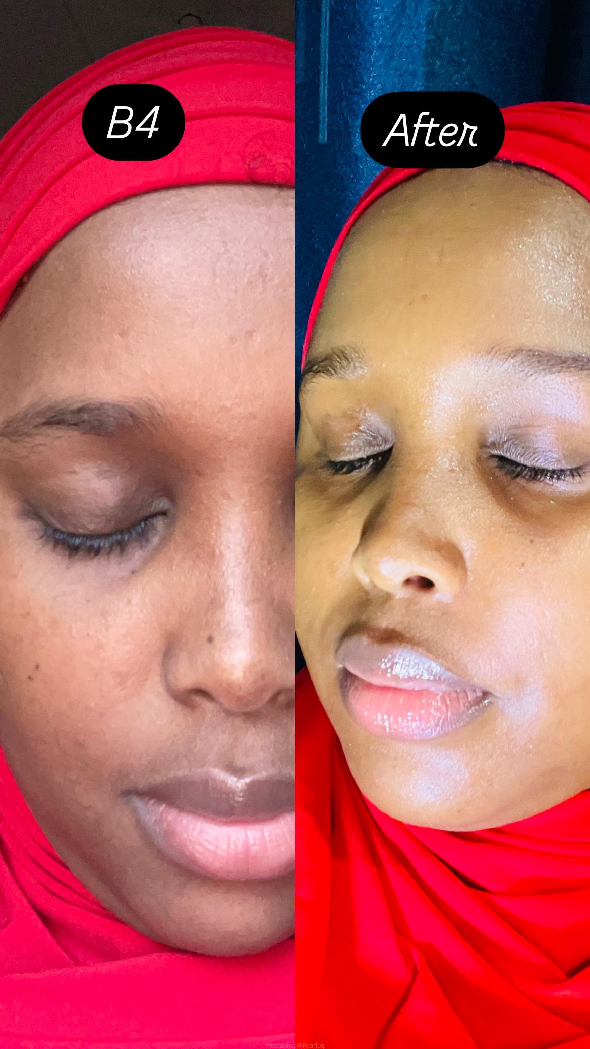 Skin care