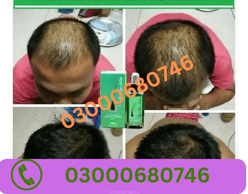 Neo Hair Lotion Price in Gujranwala 03000680746
