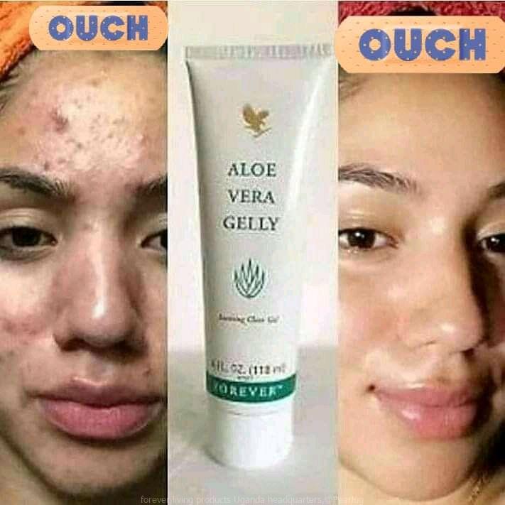 Aloe vera gelly tube